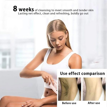 Professional Permanent IPL Laser Hair Removal Painless