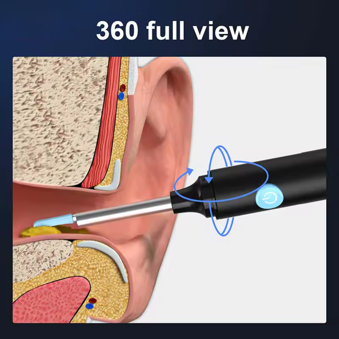 White Ear Wax Removal Tool with Camera – HD Ear Cleaner with 6 LED Lights