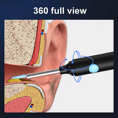 White Ear Wax Removal Tool with Camera – HD Ear Cleaner with 6 LED Lights
