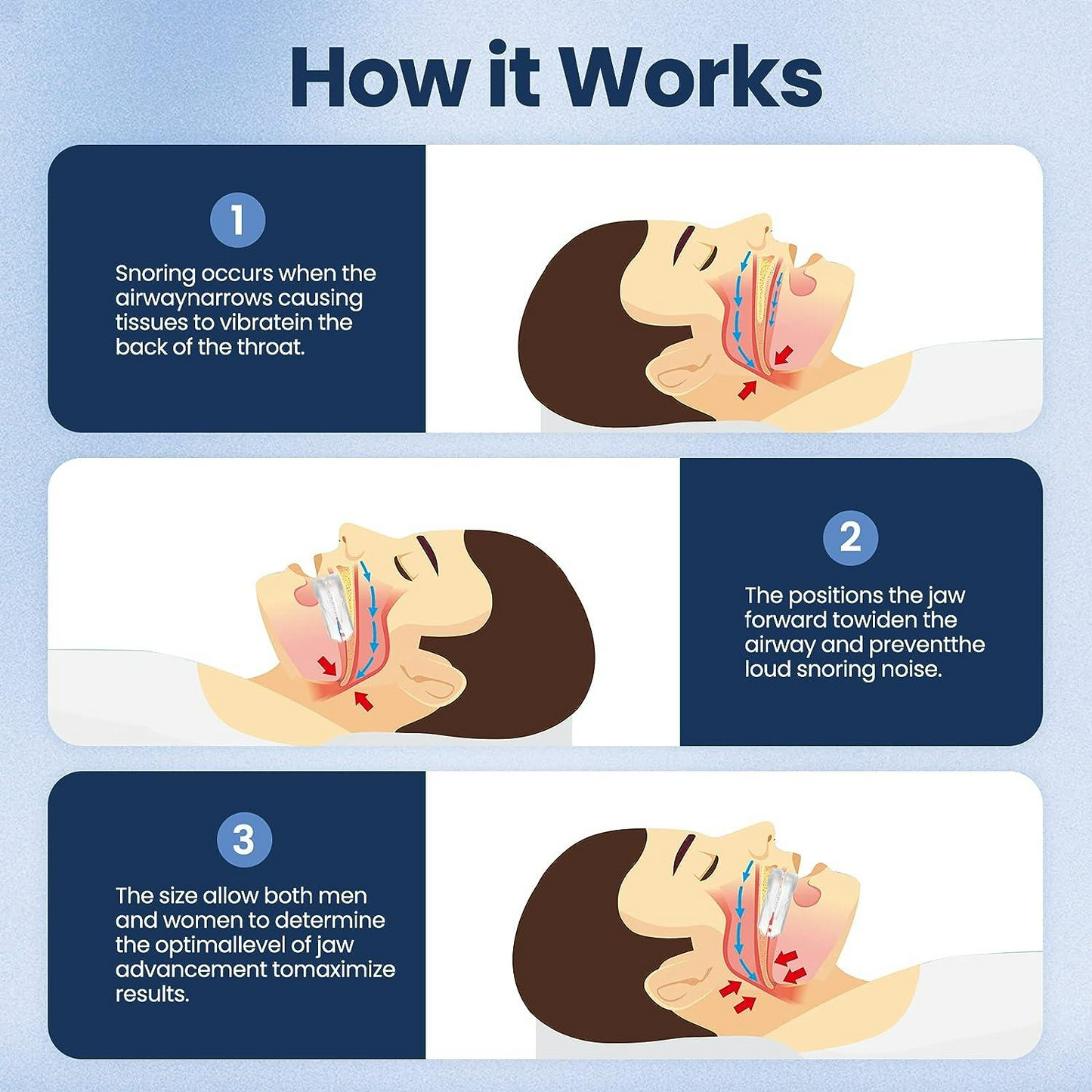 Anti-Snoring Mouth Guard – Comfortable Mouthpiece for Men & Women