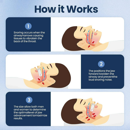 Anti-Snoring Mouth Guard – Comfortable Mouthpiece for Men & Women