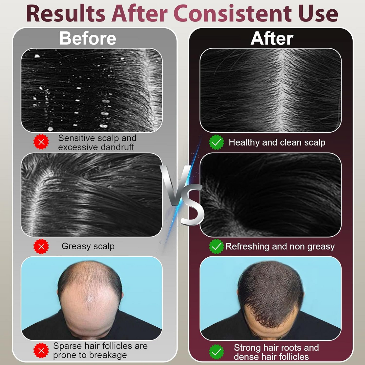 Laser Therapy Hair Growth Comb – Electric Scalp Massager & Hair Oil Applicator Waterproof