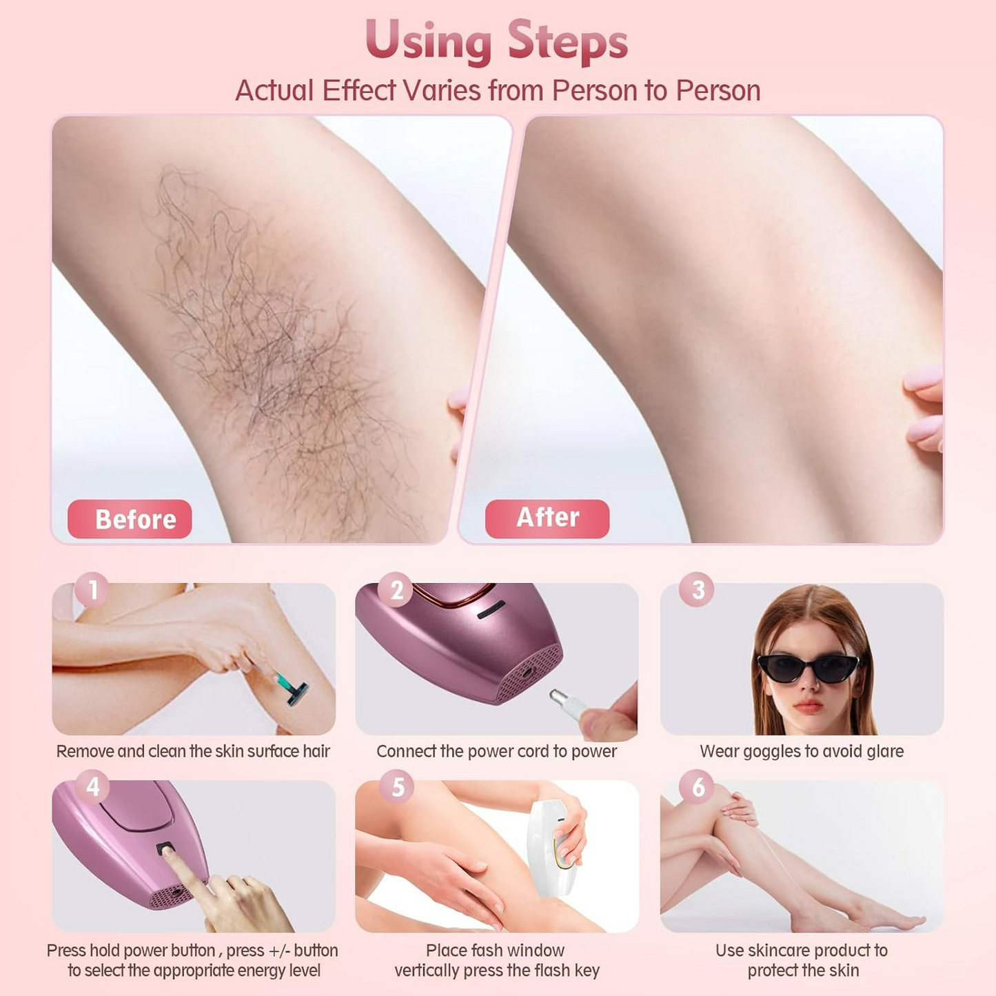 IPL Hair Removal Devices, Hair Removal, Laser Permanent Hair Removal, Laser Hair Remover,