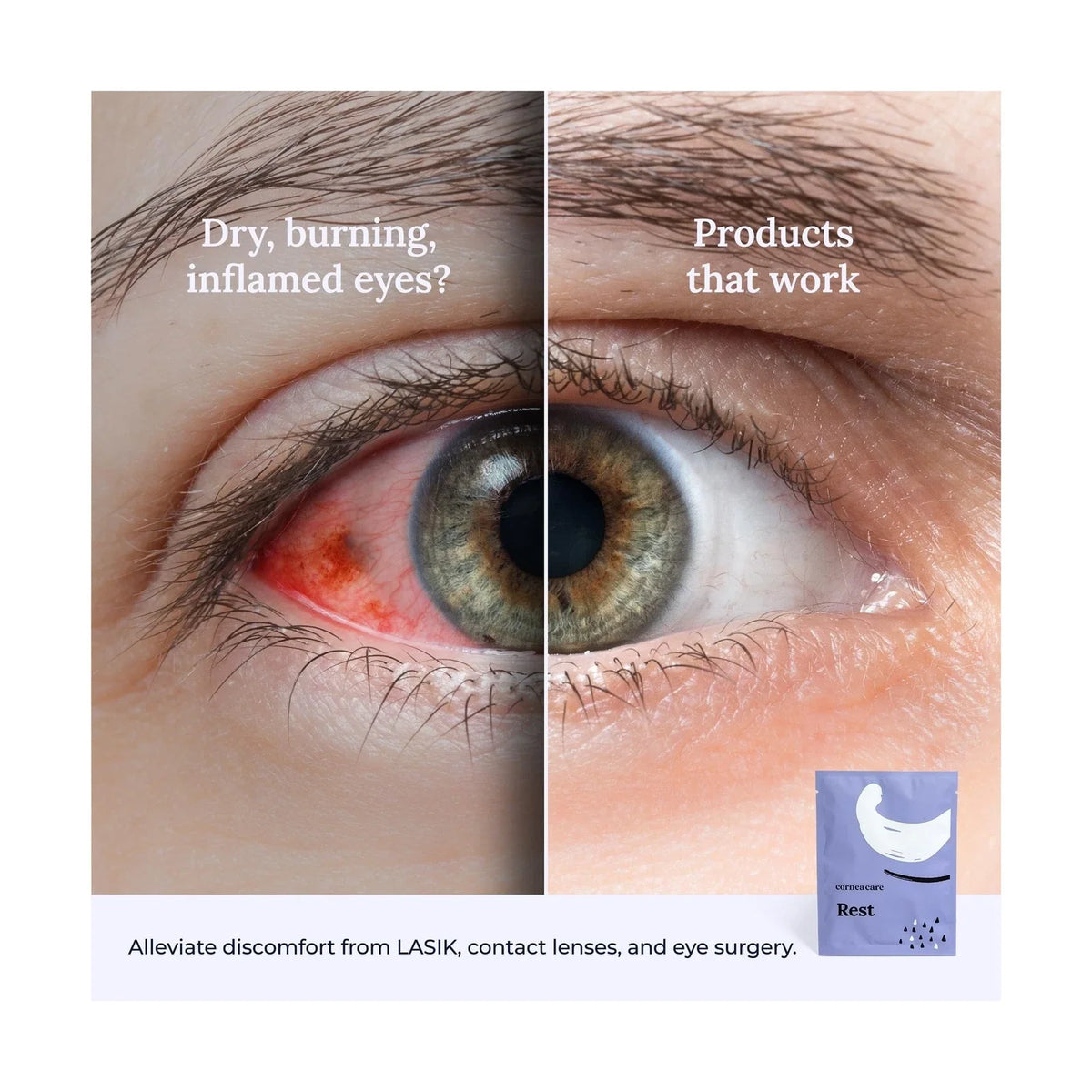 Corneacare Self Heating Warm Compress for Eyes HSA/FSA APPROVED